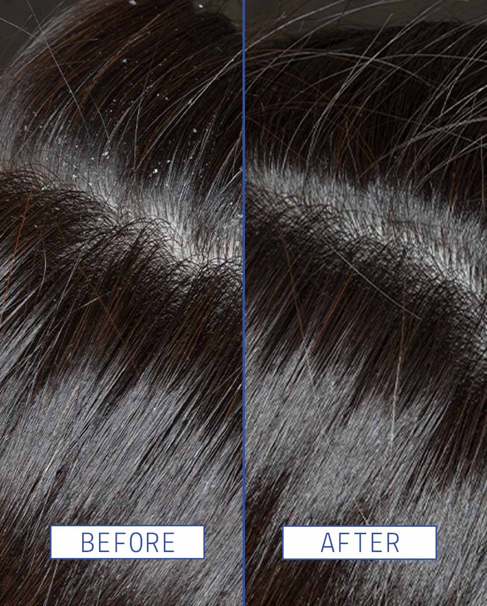 AAVRANI Dry Scalp Rescue Serum before and after