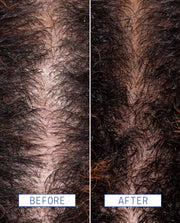 Close-up shot of a scalp before using Scalp Detox Jelly Cleanser and after using Scalp Detox Jelly Cleanser