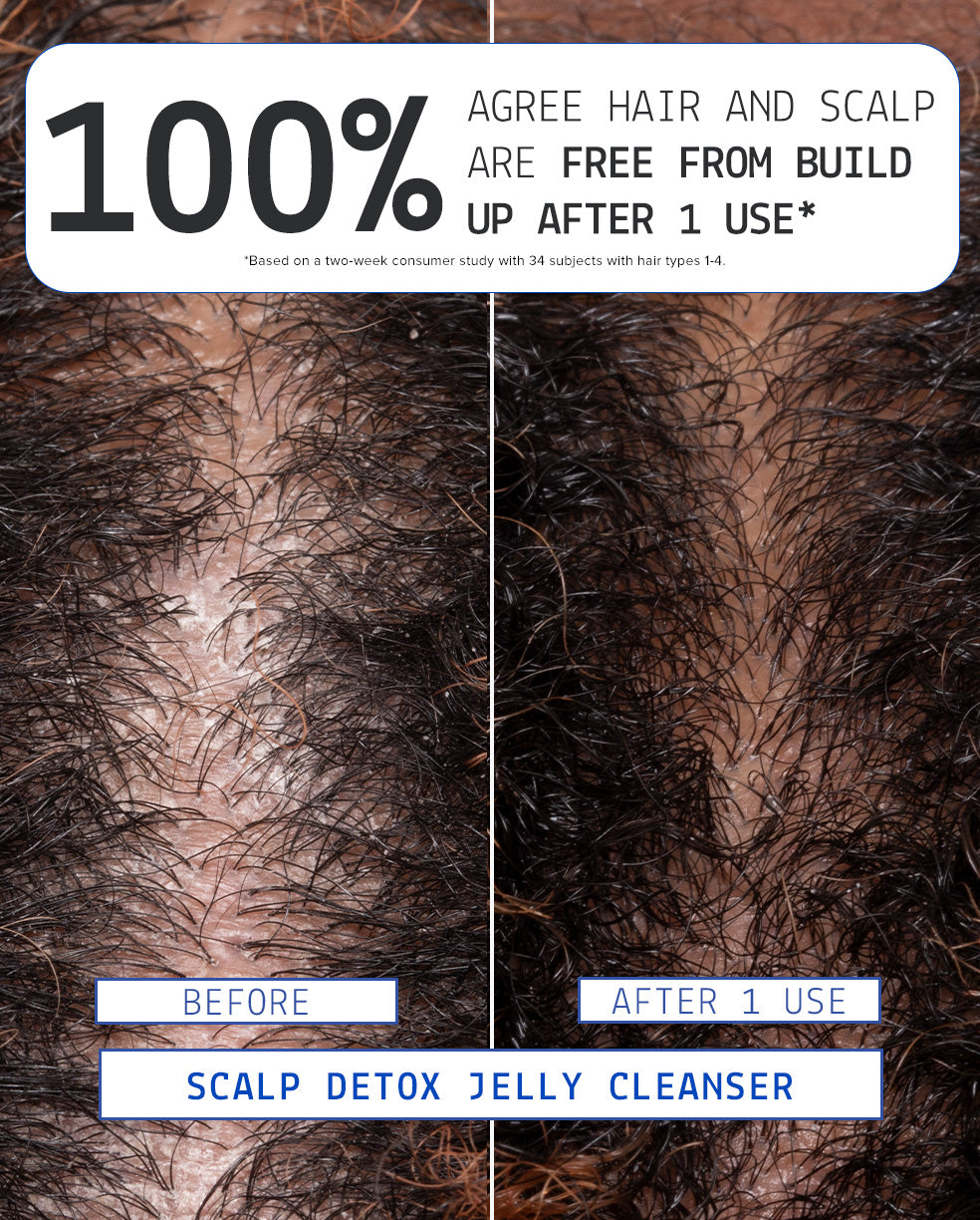 Clinical result and before and after of AAVRANI Scalp Detox Jelly Cleanser