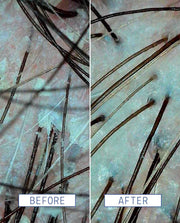 Close-up shot of a scalp before using Scalp Detox Jelly Cleanser and after using Scalp Detox Jelly Cleanser